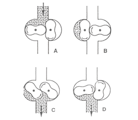 Giải pháp bơm chân không khô sử dụng ổ LS